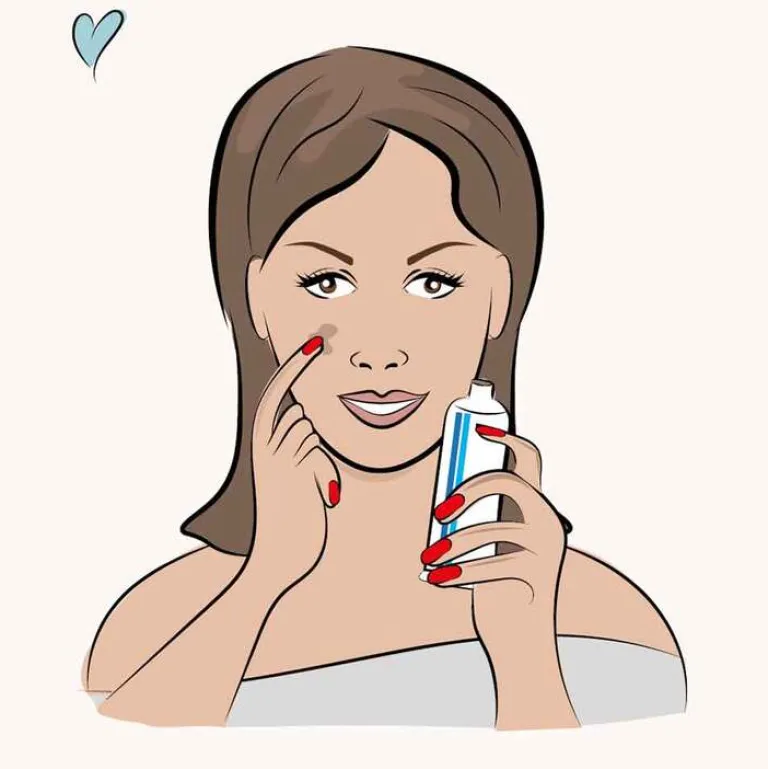 Aknederm Salbe Neu, 30 g- Akne-Creme