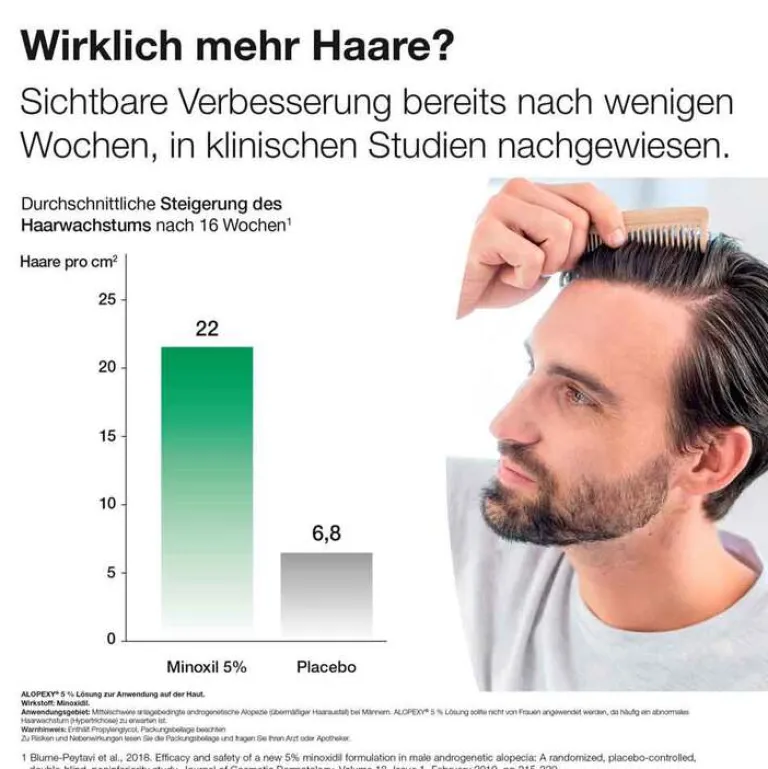 5% Lösung, 3X60 ml^Alopexy Clearance