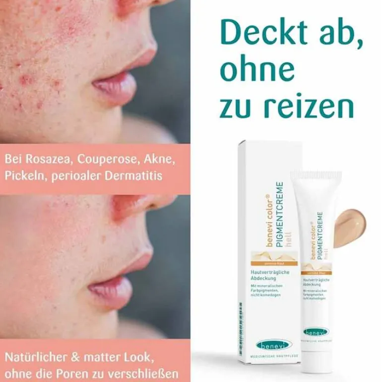 Benevi Color Pigmentcreme hell, 20 ml- Make Up|Pigmentflecken