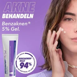 ® 5% Gel bei leichter bis mittelschwerer Akne, 2X40 g^Benzaknen