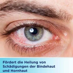 Bepanthen Augen- und Nasensalbe zur Förderung der Wundheilung, 10 g- Nasensalbe|Augensalbe
