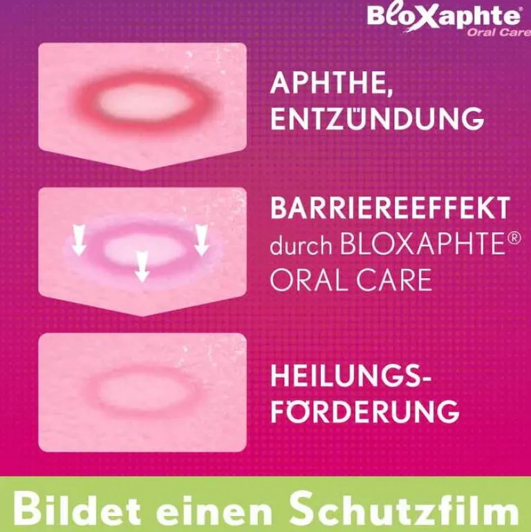 Bloxaphte Mundpflege|Zahnfleischentzündung Medikamente-® Oral Care Mundgel, 15 ml