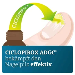 CICLOPIROX ® 80 mg/g wirkstoffhaltiger Nagellack, 6.6 ml^ADGC Online