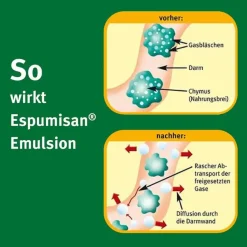 Espumisan Emulsion, 3X32 ml-Kinder Medikamente Gegen Blähungen|Mittel Gegen Blähungen