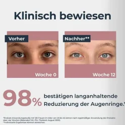 Eucerin Anti-Pigment Augenpflege Augenringe, 15 ml- Augenpflege