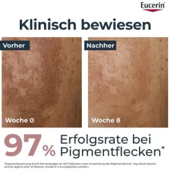Eucerin Anti-Pigment Dual Serum - Pigmentflecken, 30 ml- Serum & Kur|Pigmentflecken
