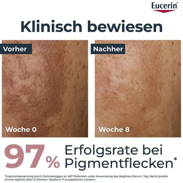 Eucerin Tagespflege|Pigmentflecken-Anti-Pigment Tagescreme LSF 30, 50 ml