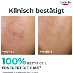 Eucerin Unreine Haut|Hauttypen-Dermopure Clinical Peeling 10 Nachtcreme, 40 ml