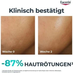 Dermopure Clinical Hydra Repair Creme, 40 ml^Eucerin Online