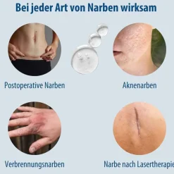 Evolsin Narbenpflege-Narben Gel, 20 g