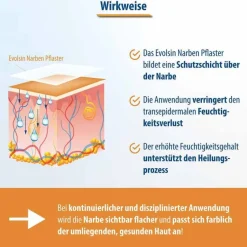 Narbenpflaster 2,5cm x 200cm, 1 St^Evolsin Sale