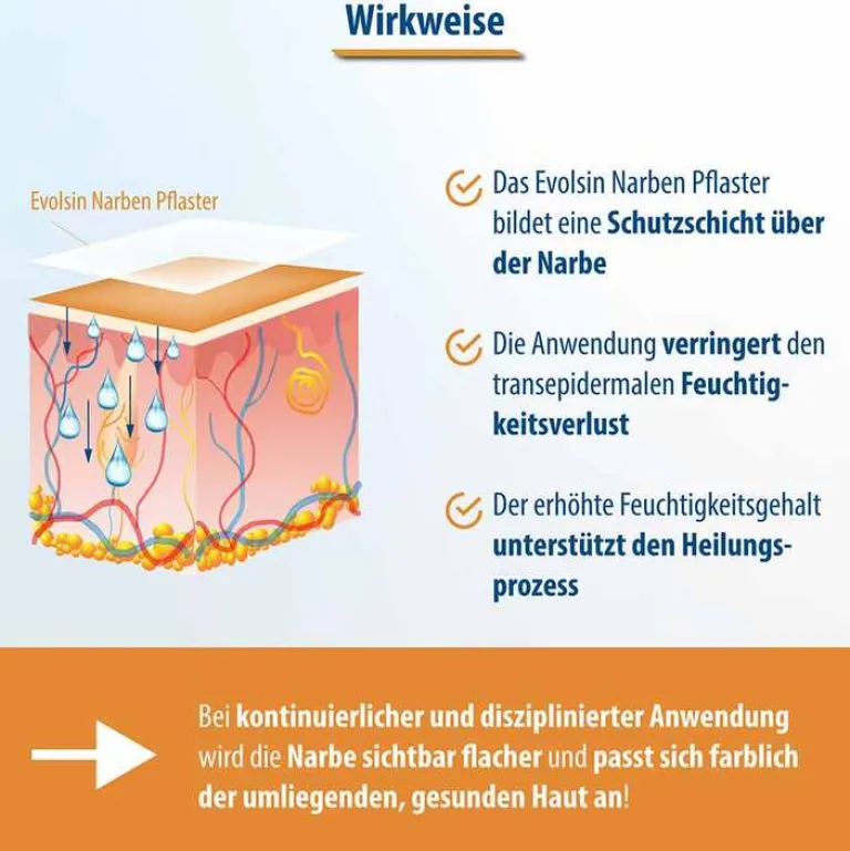 Narbenpflaster 2,5cm x 200cm, 1 St^Evolsin Sale