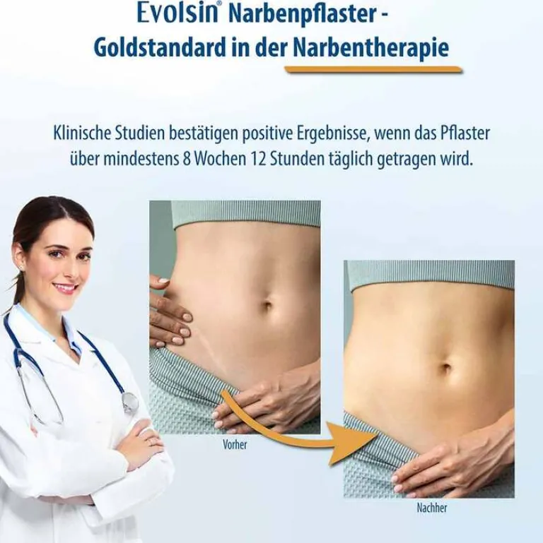 Narbenpflaster 2,5cm x 200cm, 1 St^Evolsin Sale