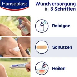 Hansaplast Fixierbinde selbsthaftend 6 cmx4 m blau, 1 St- Haft- & Fixierbinden