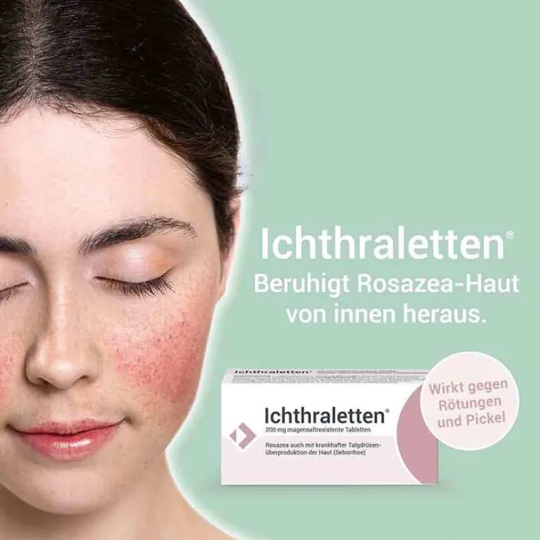 Ichthraletten® 200 mg Tabletten bei Rosazea, 84 St^Ichtraletten Online