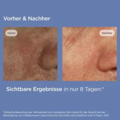 Isdin Trockene Haut-Nutradeica Gel-Creme Gesicht, 50 ml