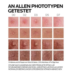 La Roche Posay Effaclar Duo + M Creme, 40 ml- Unreine Haut|Hauttypen