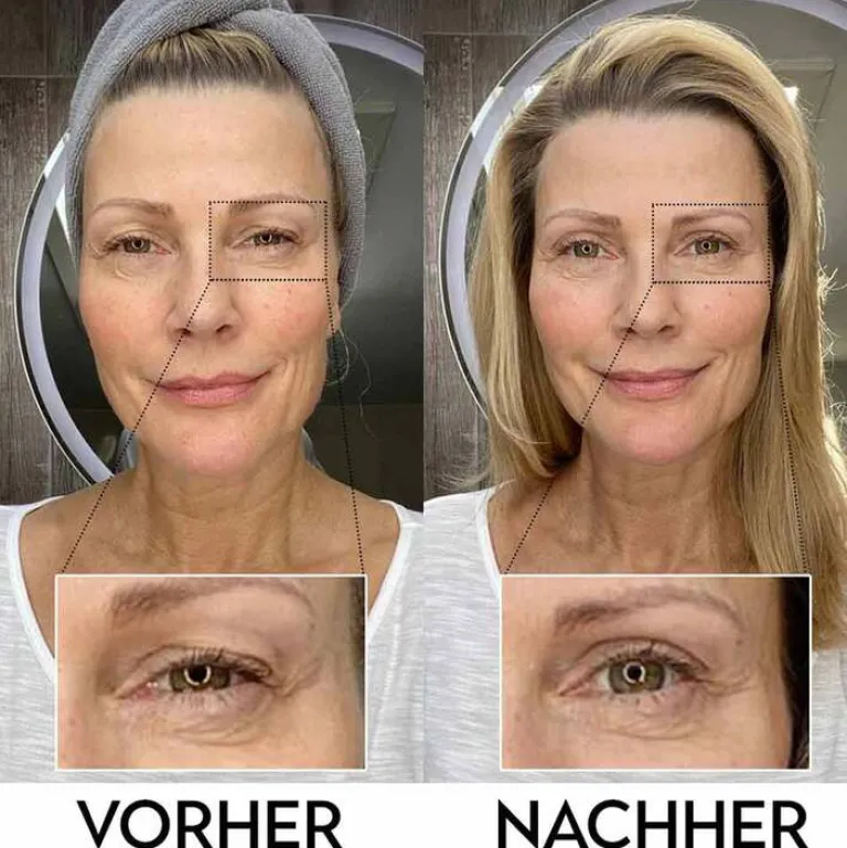 Augenpflege-Lidperfect Augengel bei Schlupflidern, 15 ml