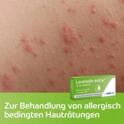 Loratadin ® 10 mg Tabletten, 7 St^axicur Outlet