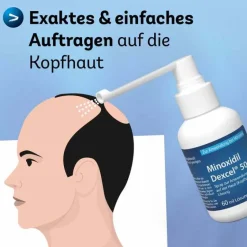 Minoxidil 50 mg / ml Spray z.Anw.a.d.Kopfhaut, 3X60 ml^Dexcel Hot