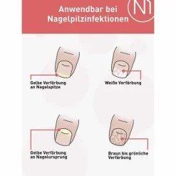 Nagelpilz Lösung, 10 ml^N1 New