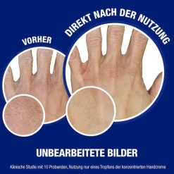 norwegische Formel Konzentrat Handcreme unparfümiert, 50 ml^Neutrogena New