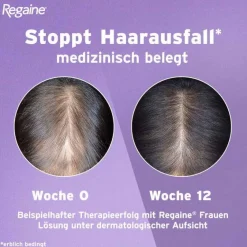 Regaine Frauen Lösung, 60 ml- Mittel Gegen Haarausfall
