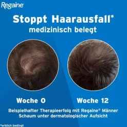 Männer Lösung, 3X60 ml^Regaine Best
