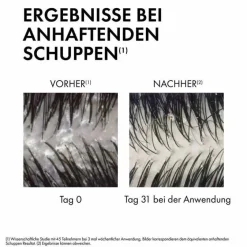 Vichy Shampoos|Kopfhautpflege-Dercos Anti-Schuppen Shampoo trockene Kopfhaut, 390 ml