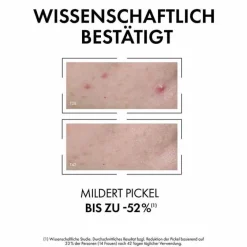 Vichy Normaderm Anti-Unreinheiten Serum, 30 ml- Unreine Haut|Serum & Kur