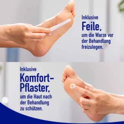 Fußwarzen Spray, 50 ml^Wartner