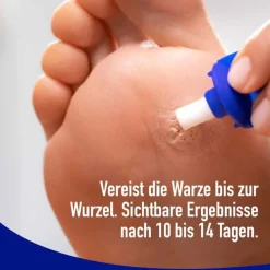 Fußwarzen Spray, 50 ml^Wartner